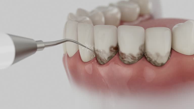 Reliable Tooth Extraction contractor in Catoosa County County, GA by Dentist Open Now
